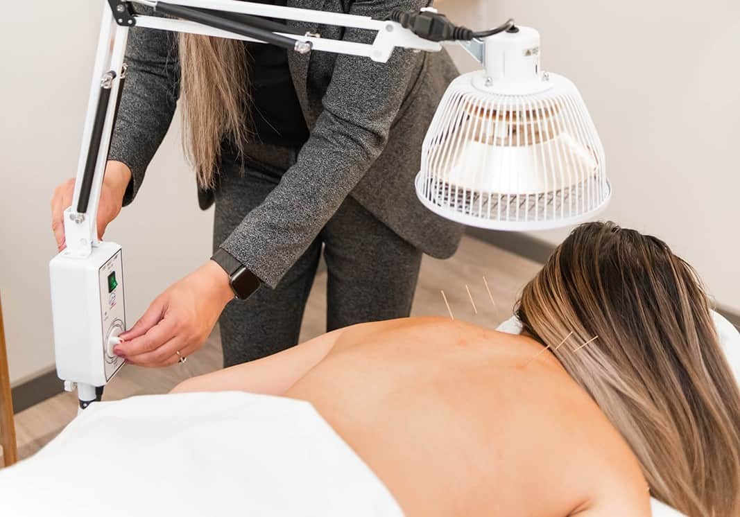 Acupuncture Langley - Near Me - 2