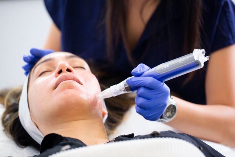 microneedling langley