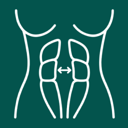Diastasis recti